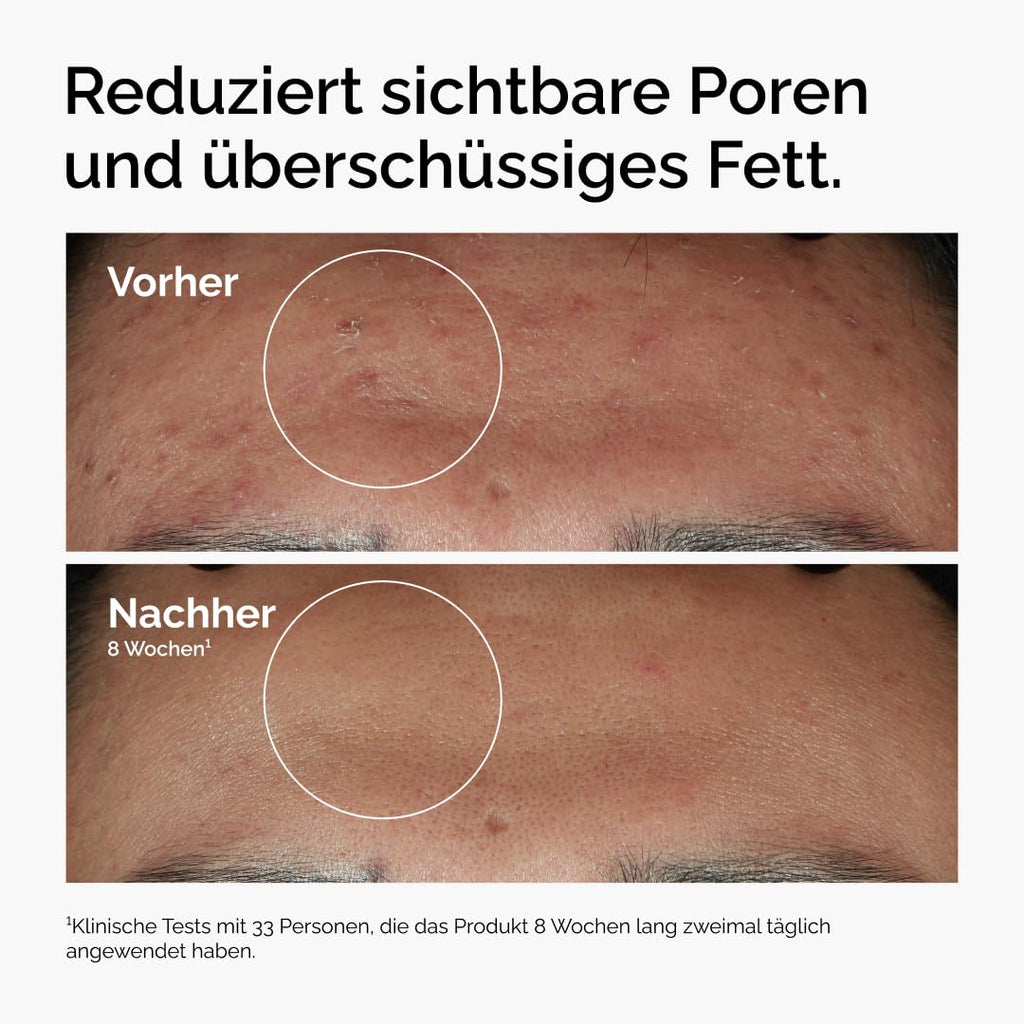 THE ORDINARY Niacinamid 10% + Zink 1%, 30Ml